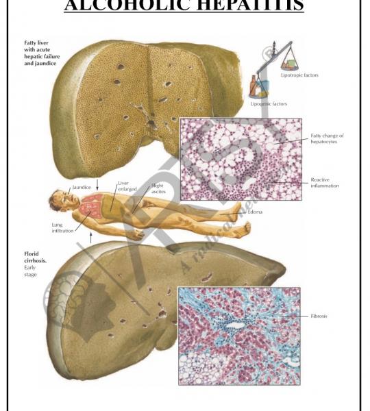 Pathology Charts