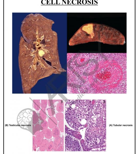 Pathology Charts