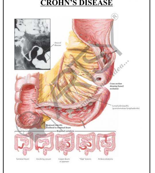 Pathology Charts