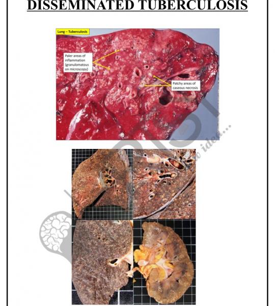 Pathology Charts