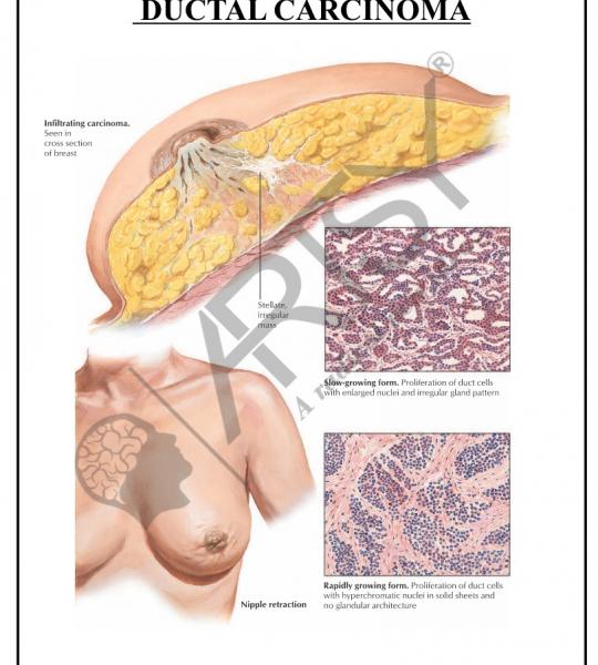 Pathology Charts