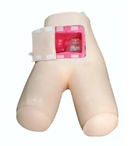 Flatus tube insertion