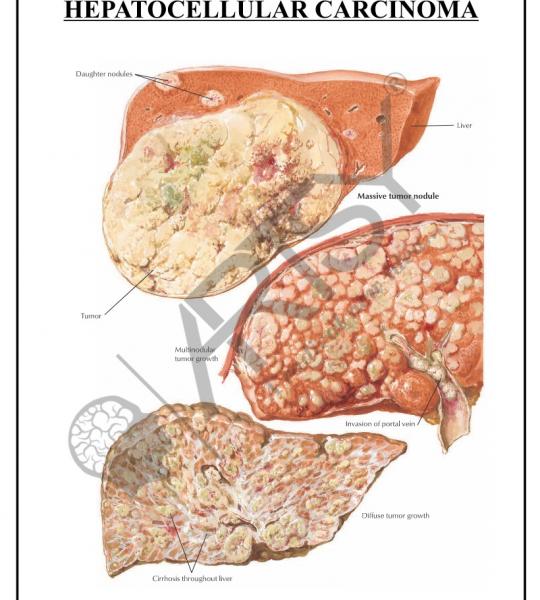 Pathology Charts