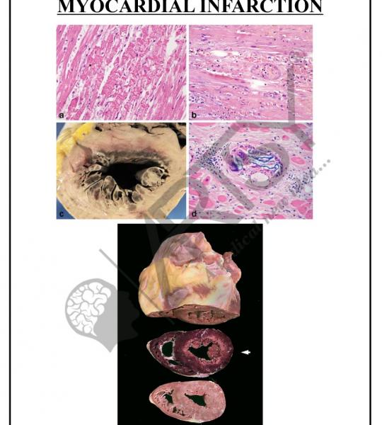 Pathology Charts