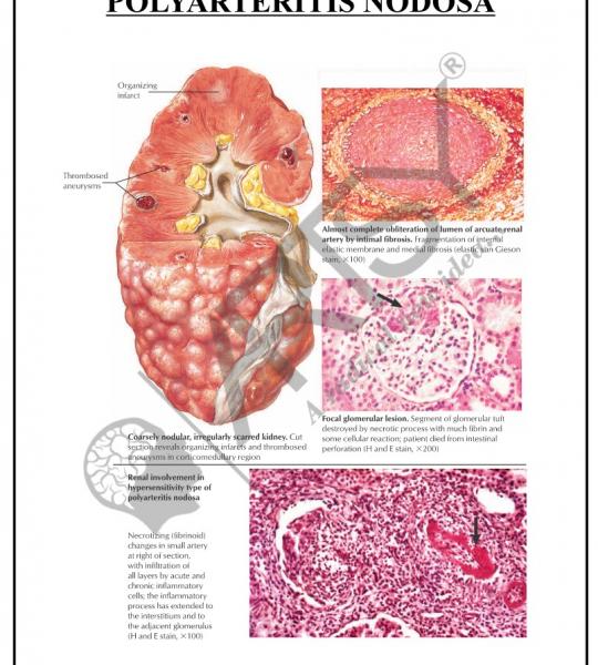 Pathology Charts