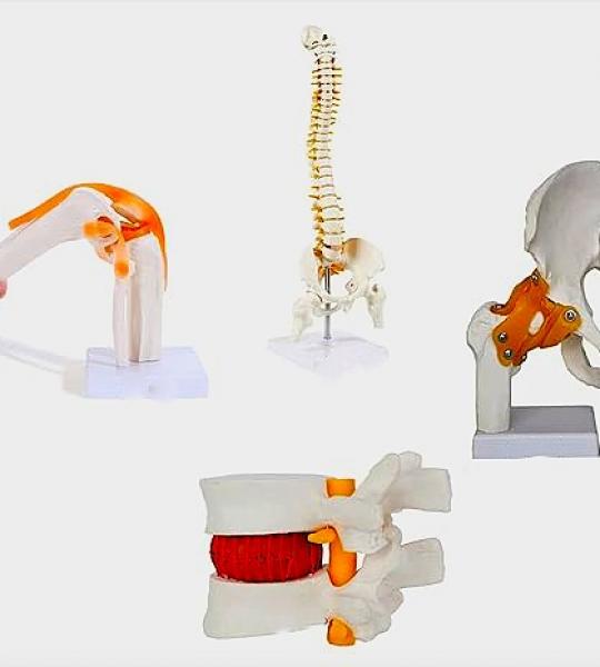 Human Joints Anatomical Models Set Of 4 - Knee Joint Model, Spine Model, Hip Joint Model And Lumbar Spine Herniation Prolapse Model