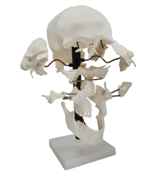 Exploded Human Skull Model