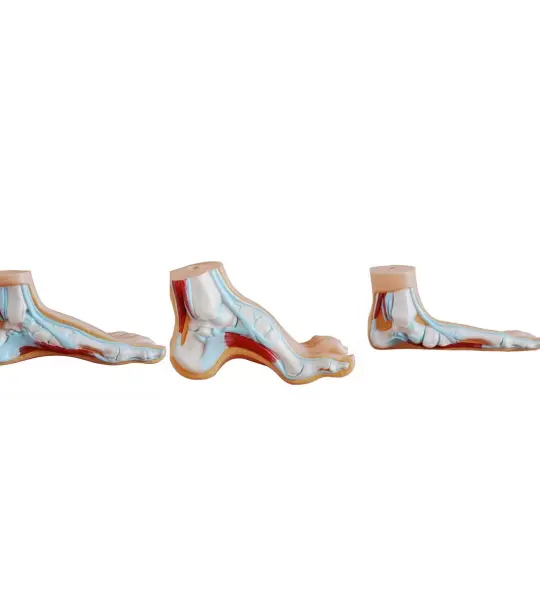 Arched Foot, Normal Foot & Flat Foot - Set of 3 Foot Anatomical Models