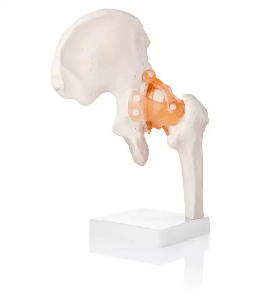 Hip Joint Model (Life-Size) With Ligaments