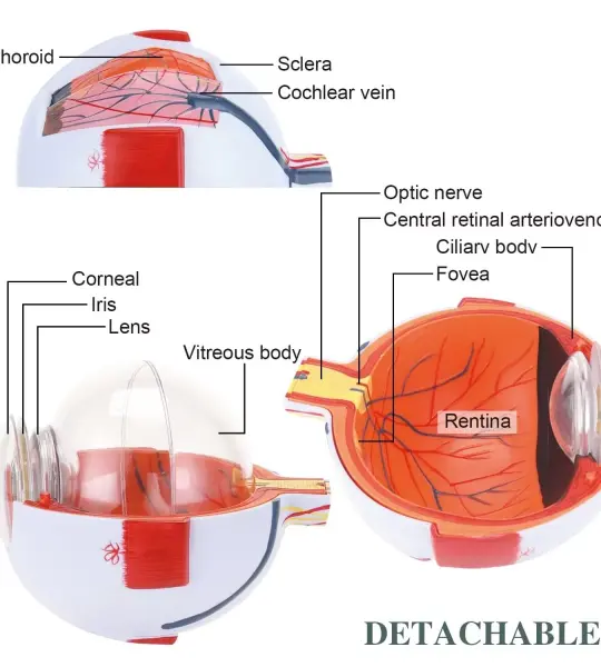 Human Eye Model (6 Times Enlarged) With 7 Dissectible Parts