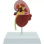 Human Kidney Model