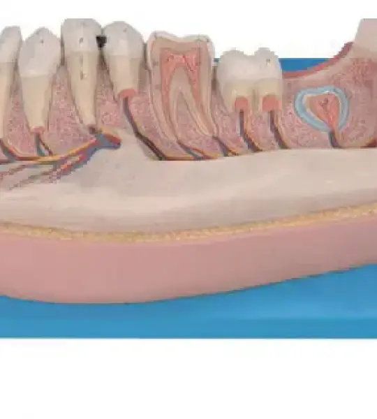 Pediatric Lower Jaw Model – 12-Year-Old