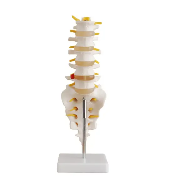 Lumbar Vertebrae With Sacrum, Coccyx and Herniated Disc (Life-Size) Anatomical Model