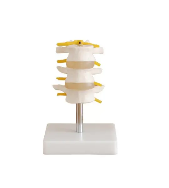 Lumbar Vertebrae (3pcs) Set Anatomical Model