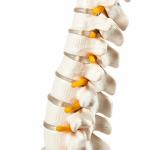 Human Spine Model – 45cm Anatomically Accurate Spine with Nerves, Pelvis & Herniated Disc