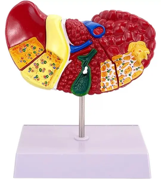 Advanced Pathological Liver Model