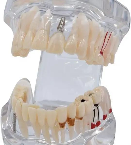 Transparent Milk Teeth Development Model