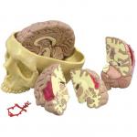 Brain Model and Partial Skull