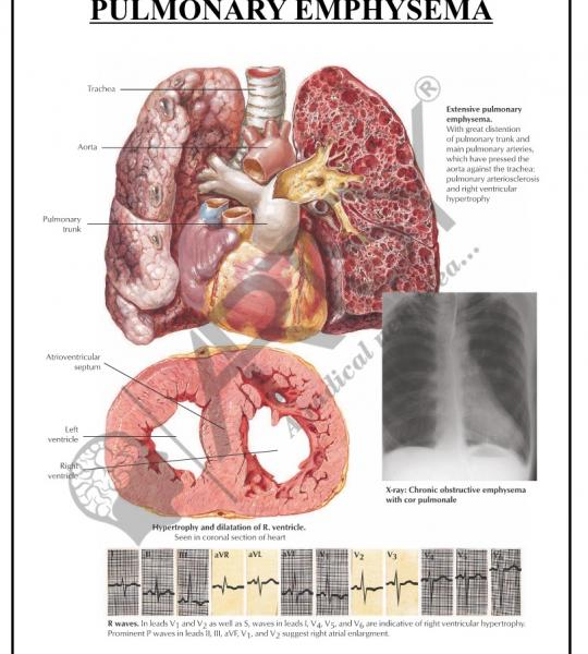 Pathology Charts