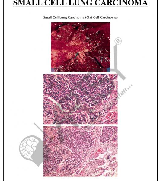Pathology Charts