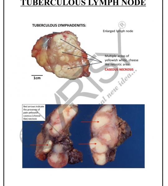 Pathology Charts