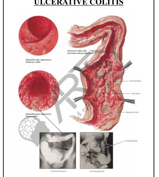 Pathology Charts