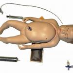 Exchange transfusion