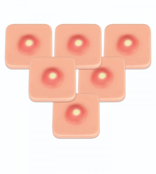 Incision and drainage trainer